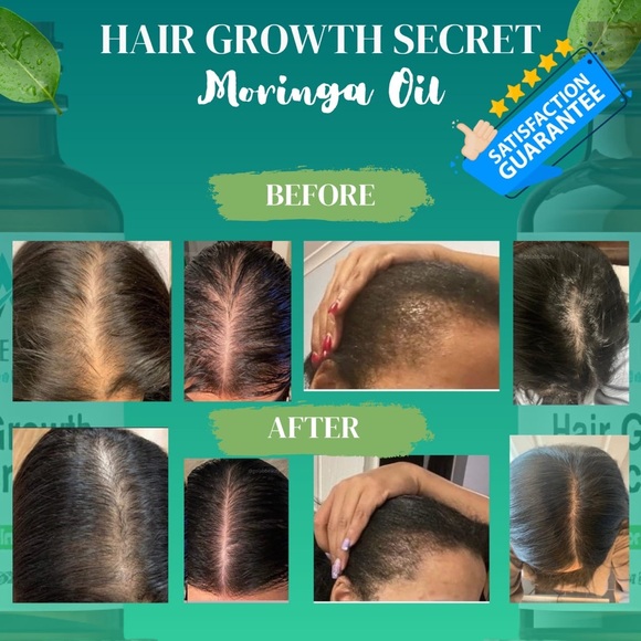 Hair Growth Olive Moringa Oil - Picture 2 of 8